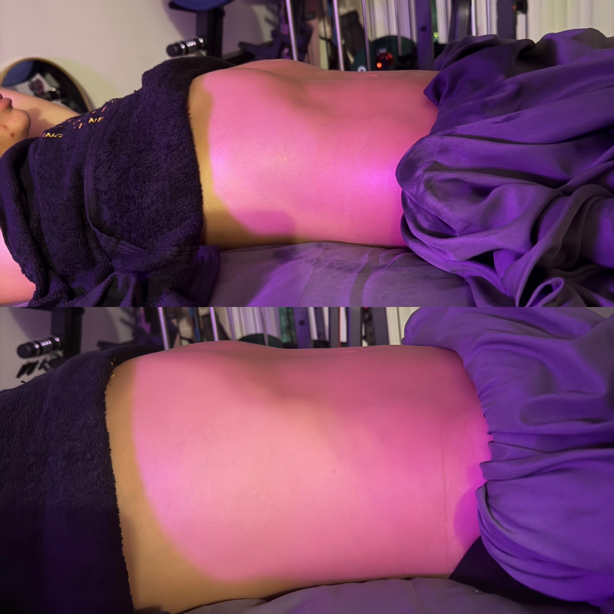Lymphatic drainage before and after result
